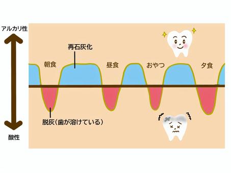 アメは虫歯になりやすい？