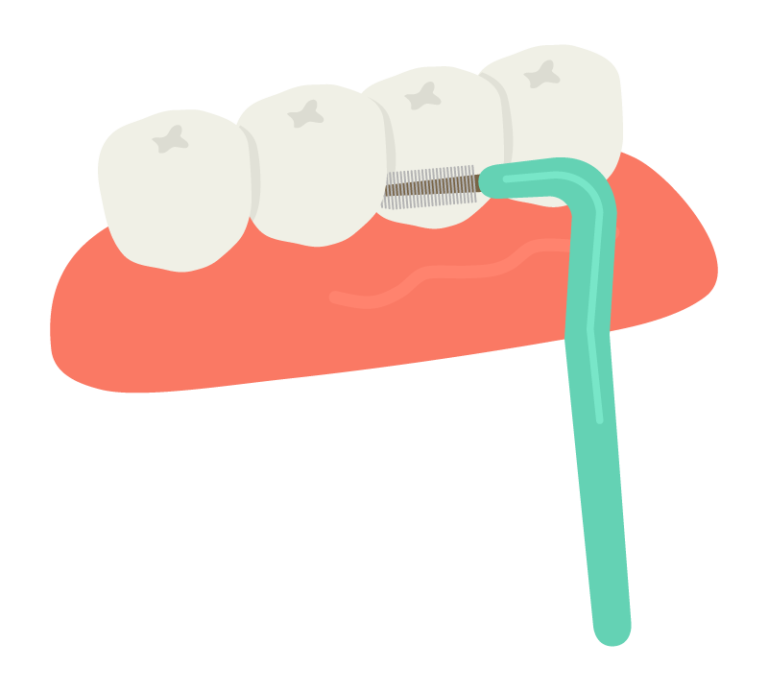 デンタルフロスと歯間ブラシはどっちがいい？