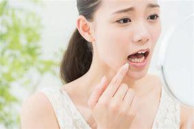 治療した銀歯が染みる！？